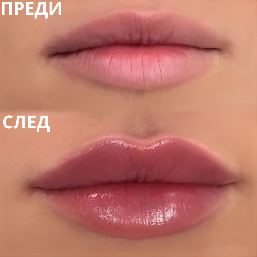Lipzy - Гланц за уголемяване на устни